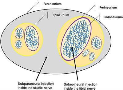 Short-Term Effects of Deliberate Subparaneural or Subepineural Injections With Saline Solution or Bupivacaine 0.75% in the Sciatic Nerve of Rabbits